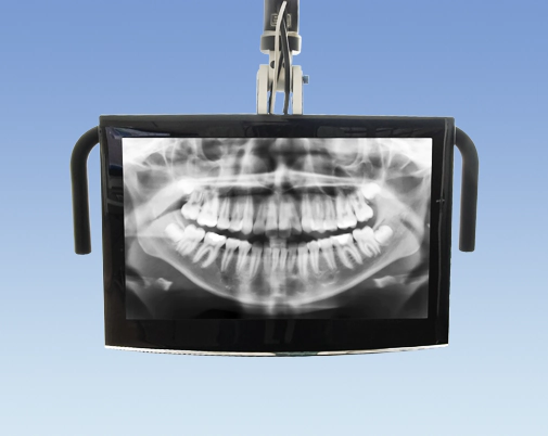 dental x-rays